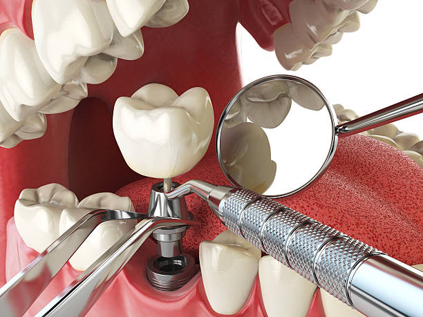 Best Emergency Dental Care for Trauma or Injury in Manorville, NY